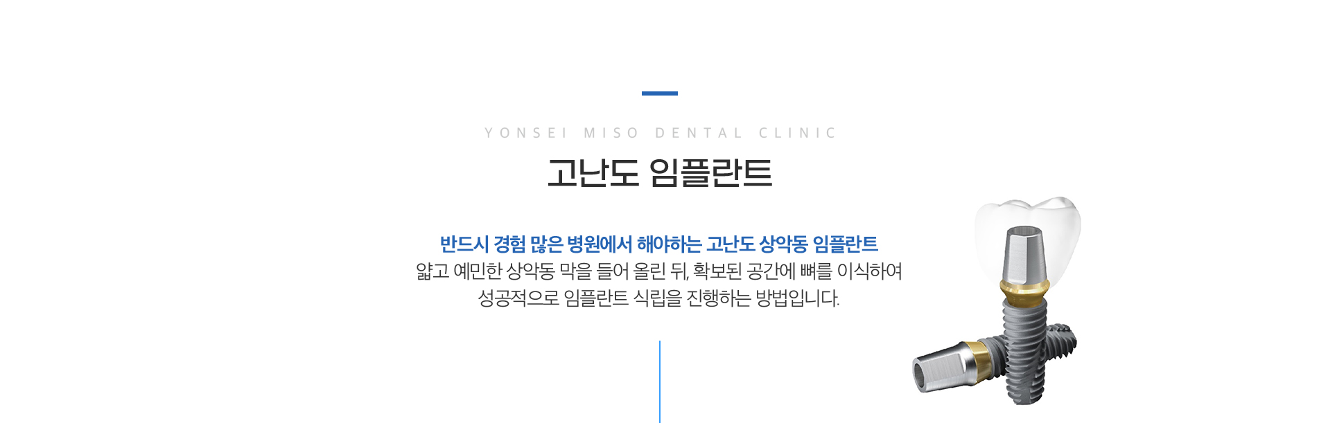 고난도 임플란트