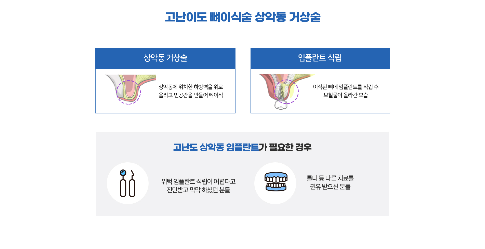 고난이도 뼈이식술 상악동 거상술