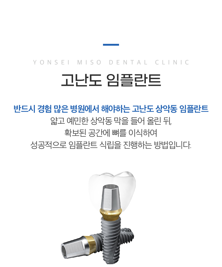 고난이도 임플란트