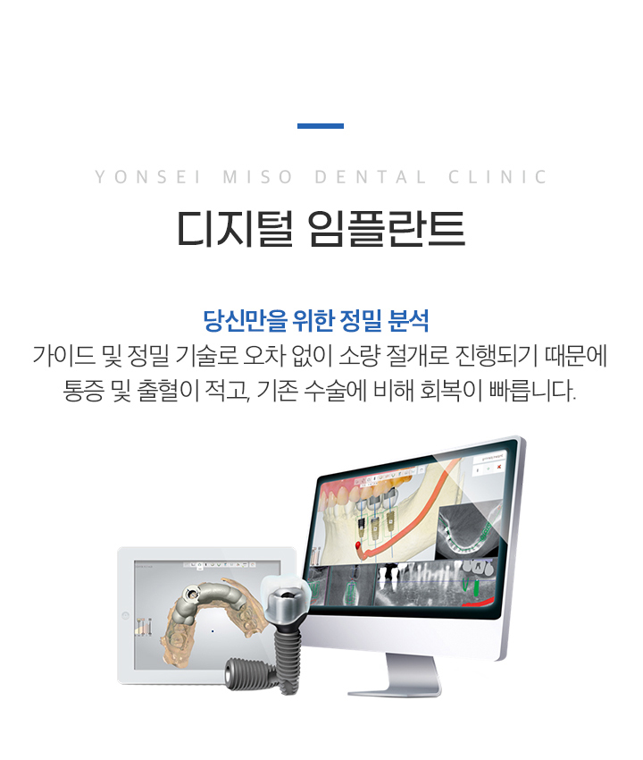 디지털 임플란트