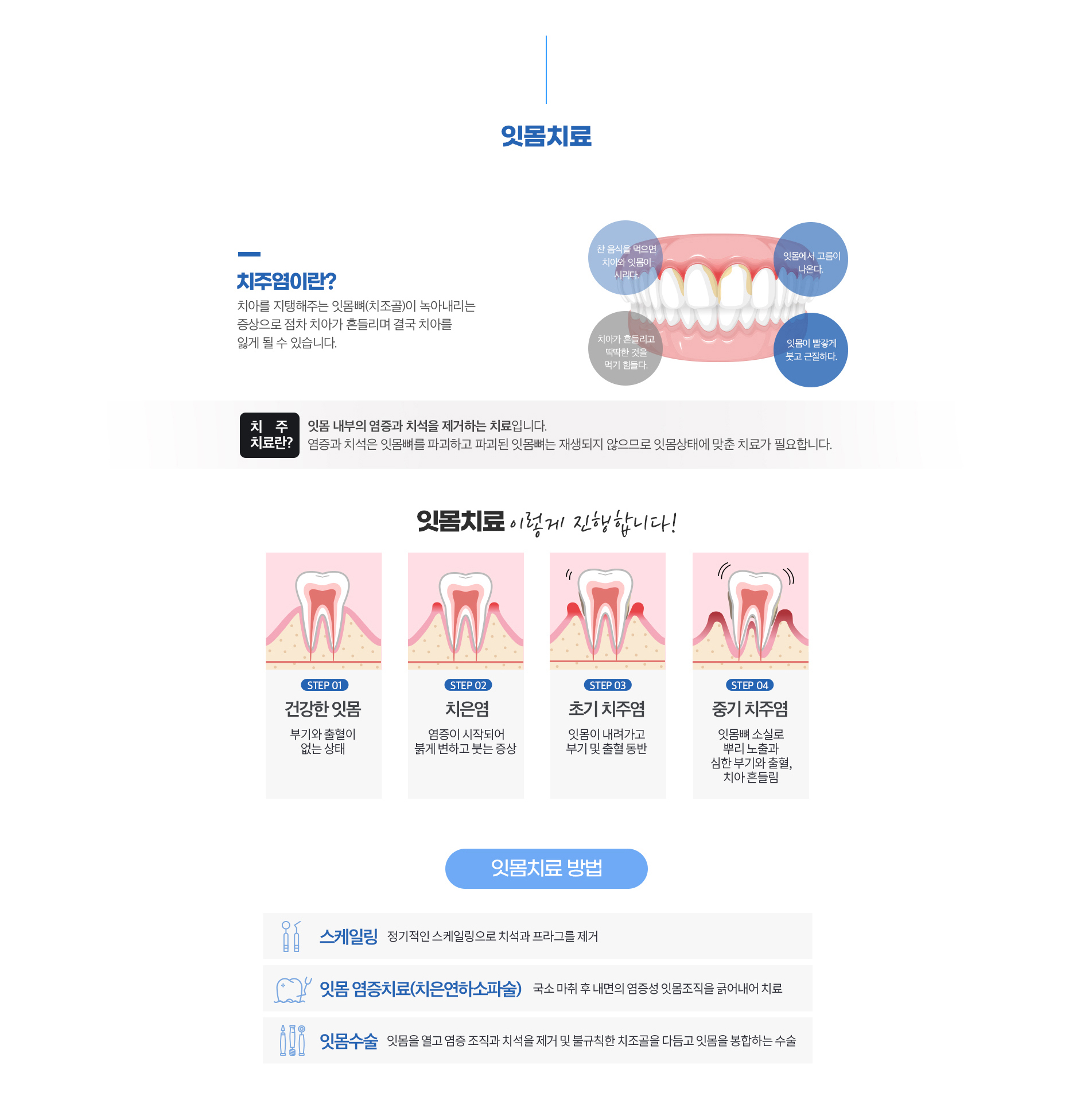 잇몸치료