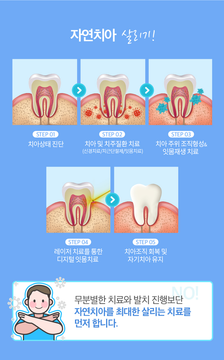 자연치아 살리기