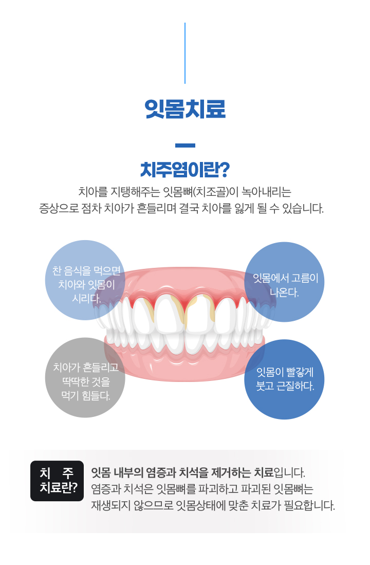잇몸치료